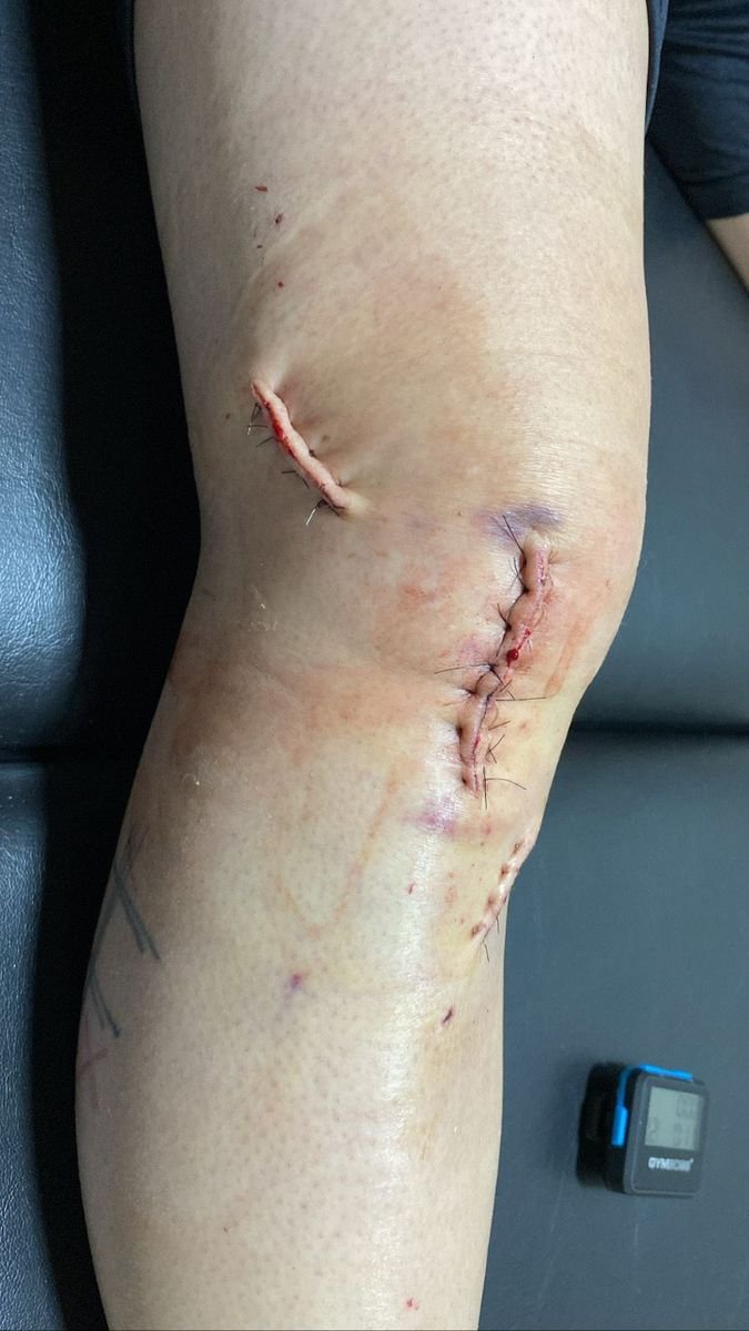 Fisioterapeuta - Flávia Naumann de Melo