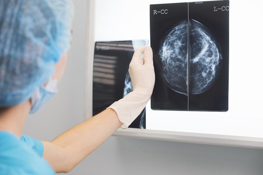 Conheça dois tipos de exames que são de extrema importância para prevenção do câncer nas mulheres