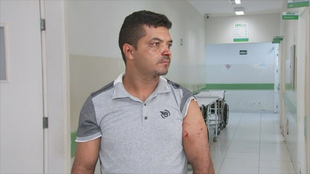 Ajudante de motorista fica ferido após ser atacado por dois pit bulls em Fernandópolis