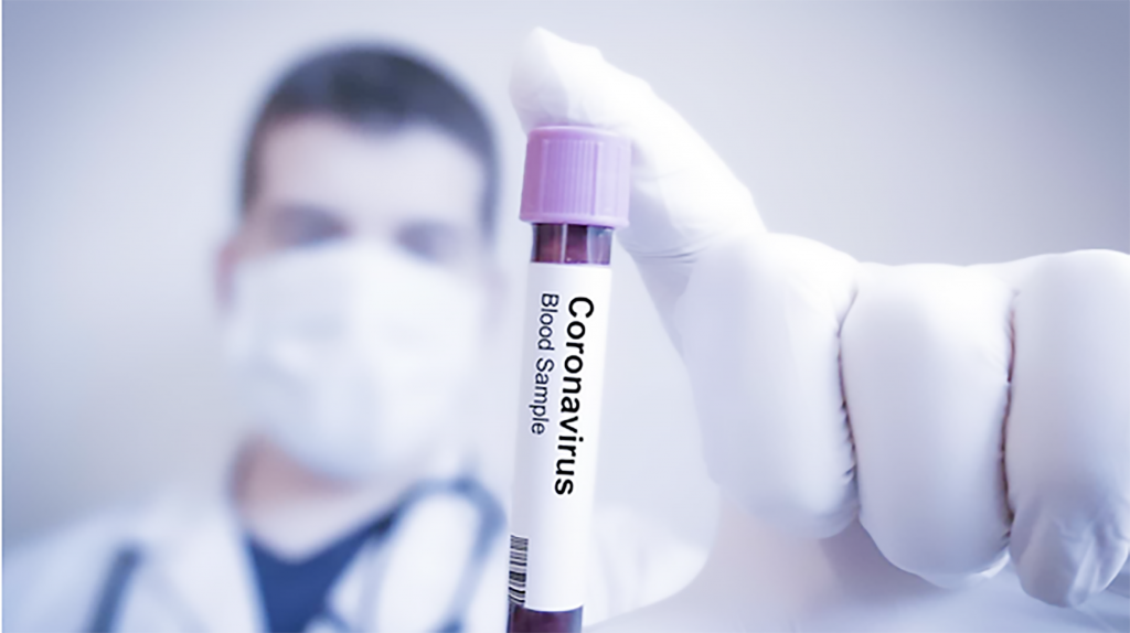 Estudo sugere que curados de Covid não transmitem mais a doença