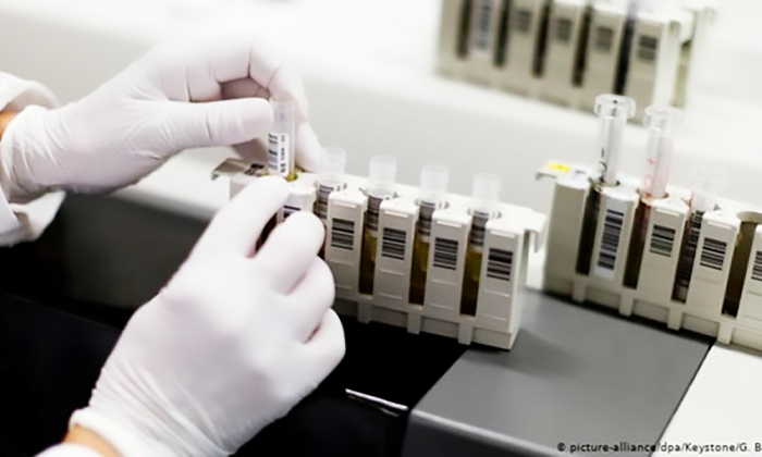 Pesquisa brasileira diz ter eliminado HIV de paciente soropositivo