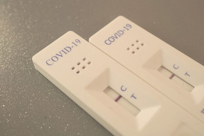 Testes para Covid-19 não servem para medir nível de anticorpos, alerta Anvisa