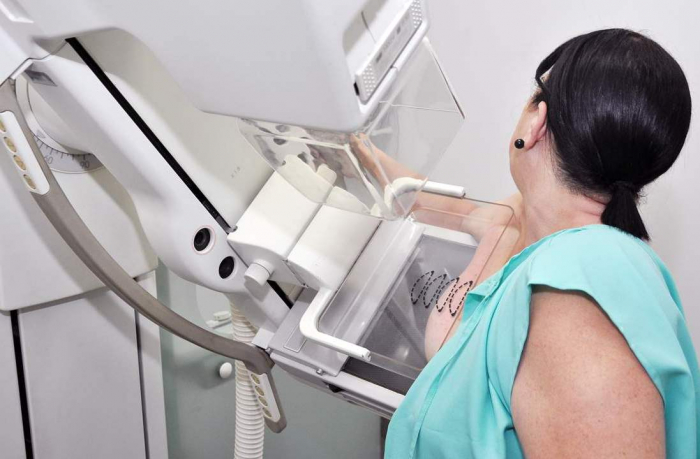Carreta da Mamografia estará em Jales para realizar exames em mulheres com idades entre 50 e 69 anos