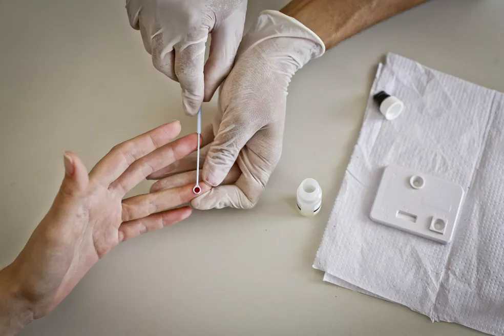 40 anos da aids no Brasil: jovens perderam medo do vírus