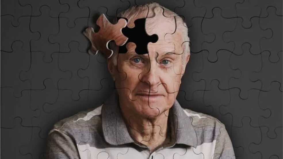 Campanha busca conscientizar a população sobre Alzheimer, fibromialgia e lúpus