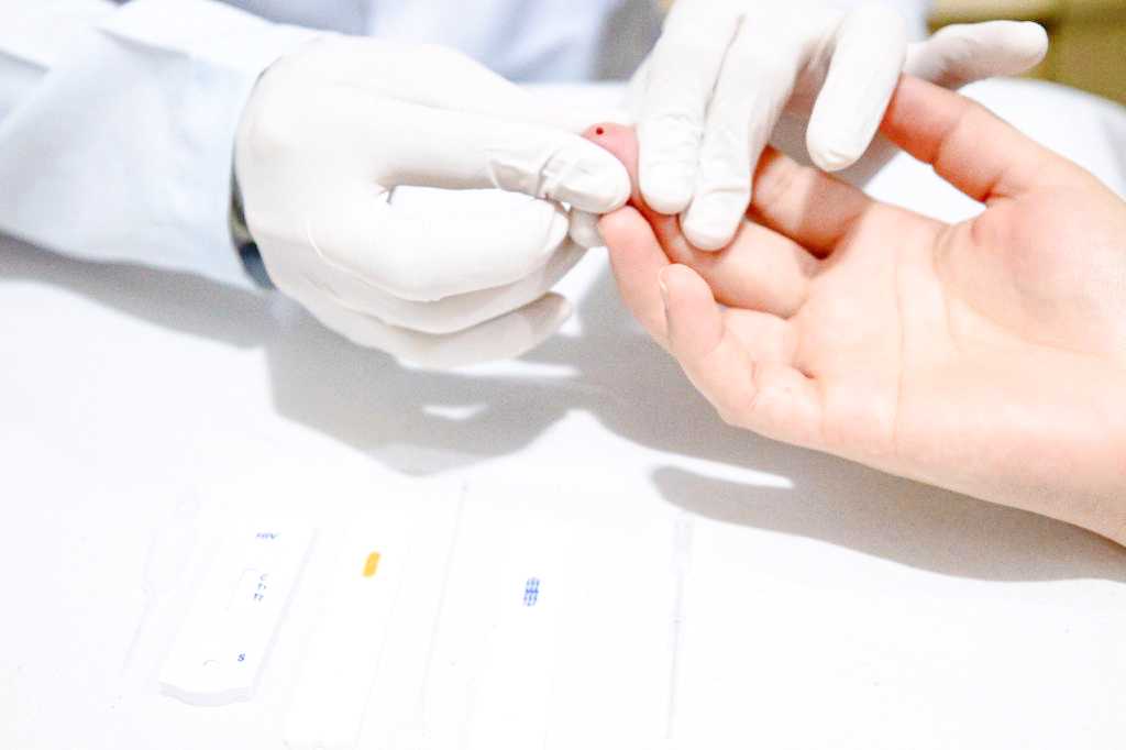 Hepatites B e C causaram 83 mil mortes em 2 décadas no País